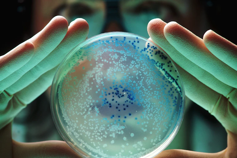 A petri dish with bacterial colonies