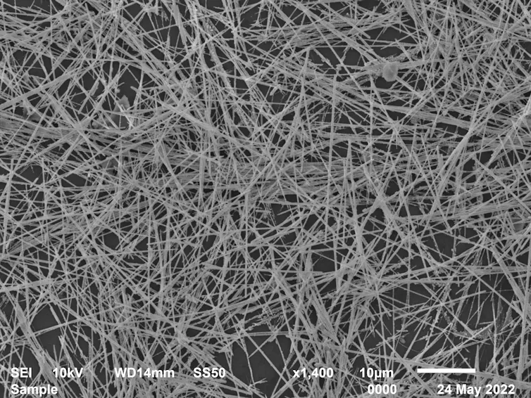 A microscope photo showing a messy web of thin grey lines against a black background.