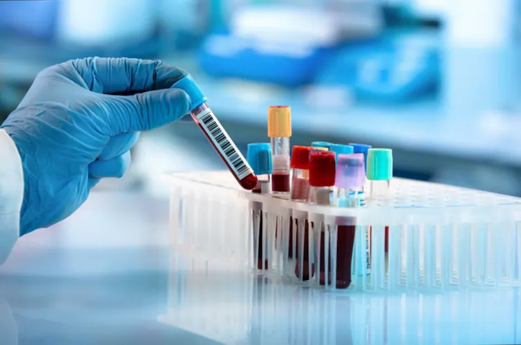 laboratory bench with a stand containing test tubes of blood. Gloved hand removes one