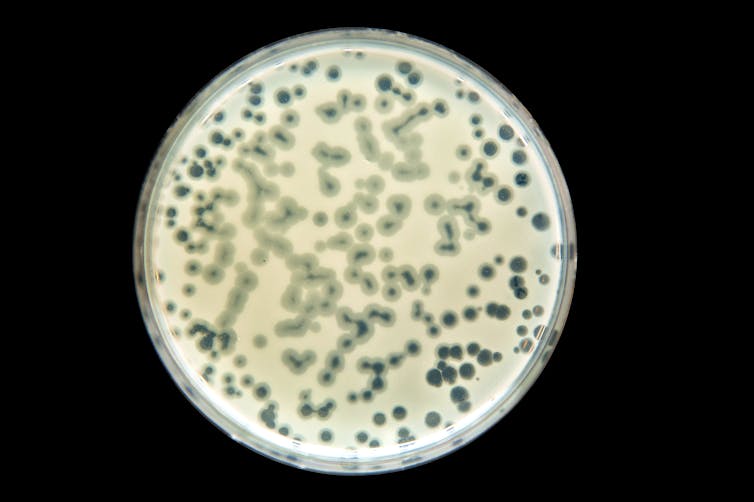 petri dish with bacterial culture with phage