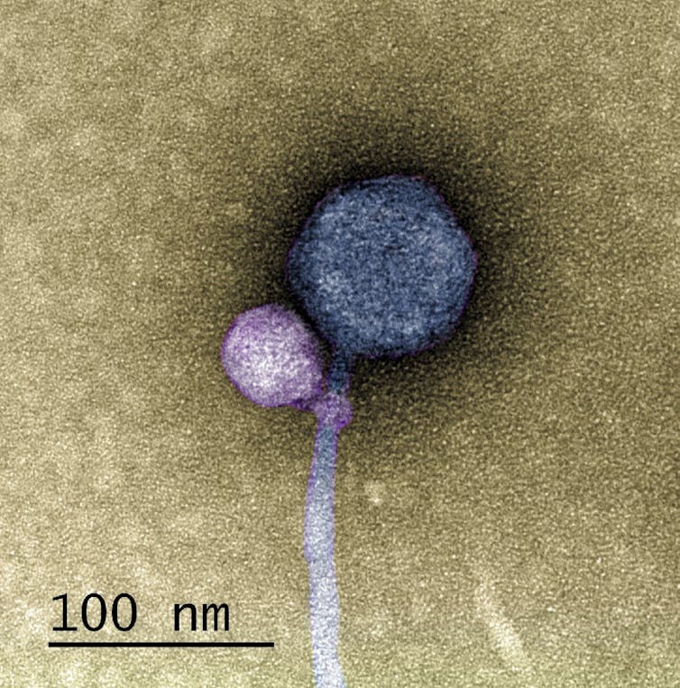 Microscopy image of a small round virus colored violet attached to the base of a larger round virus colored gray with a long tail
