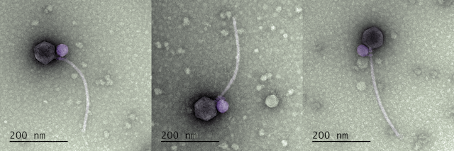 Microscopy images of a small round virus colored violet attached to the base of a larger round virus colored gray with a long tail