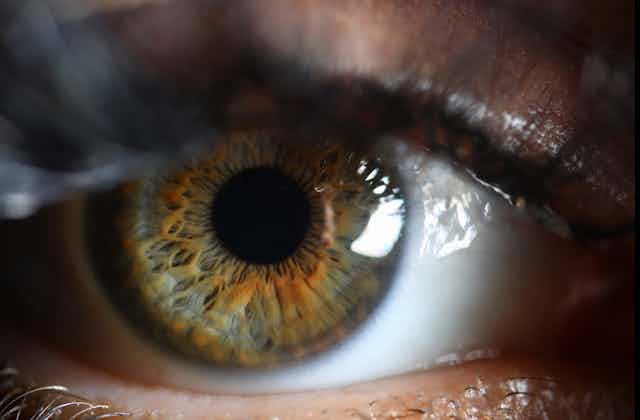 A close-up photograph of a green eye.