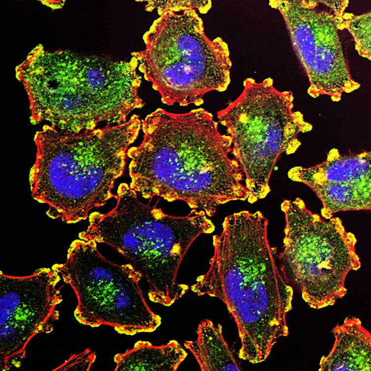 A microscope photo of fluorescent cells