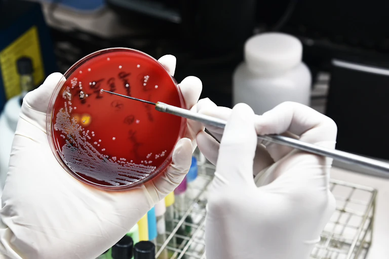 A scientist holds up a petri dish showing drugs being tested against bacteria.
