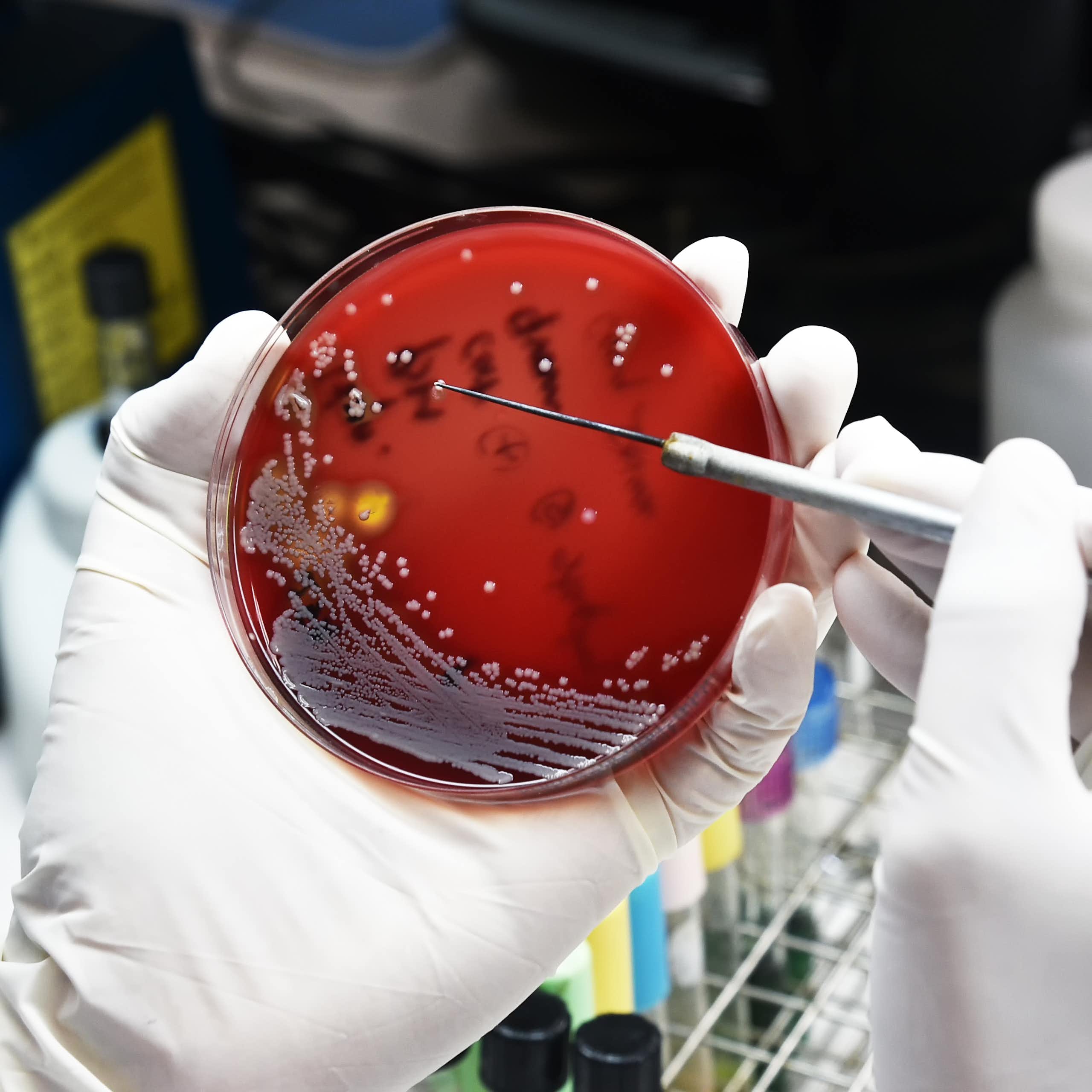 A scientist holds up a petri dish showing drugs being tested against bacteria.