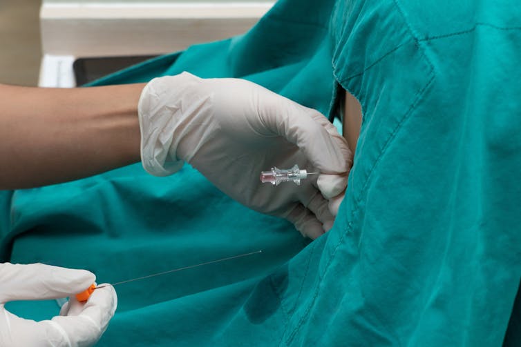 Person receiving a lumbar puncture.