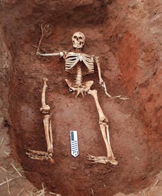 human skeleton model posed in bottom of dirt hole with ruler near feet