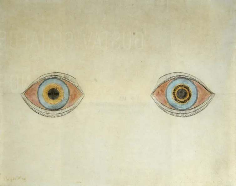 Dessin du peintre allemand August Natterer (1868–1933), atteint de schizophrénie.