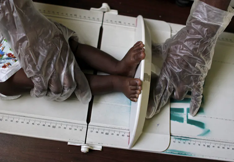 Gloved hands hold a baby's feet as it is measured.
