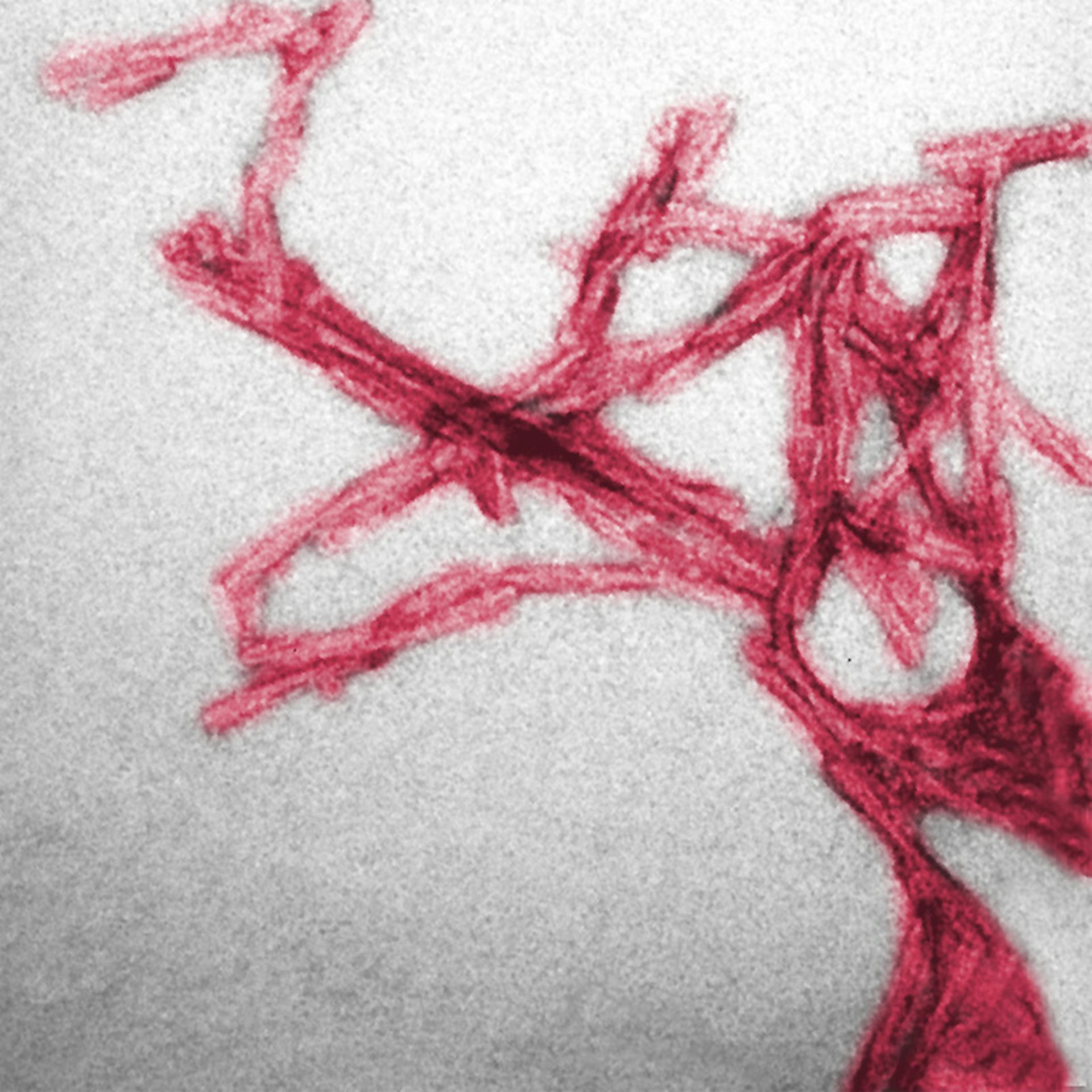 Resultado de imagen de prion microscope