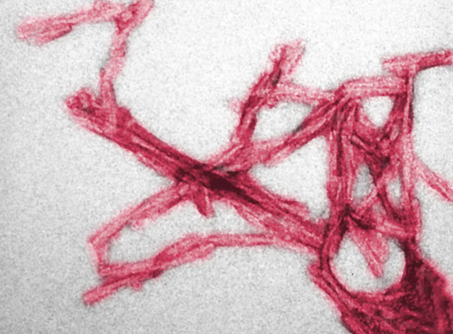 Prions Pathogen Microscope El blog de Antonio José Miralles: Microorganismos acelulares