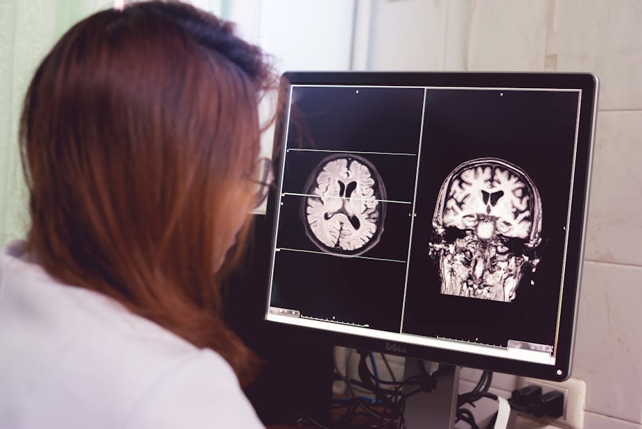 A female doctor wearing a white lab coat looks at brain scans on a computer screen.
