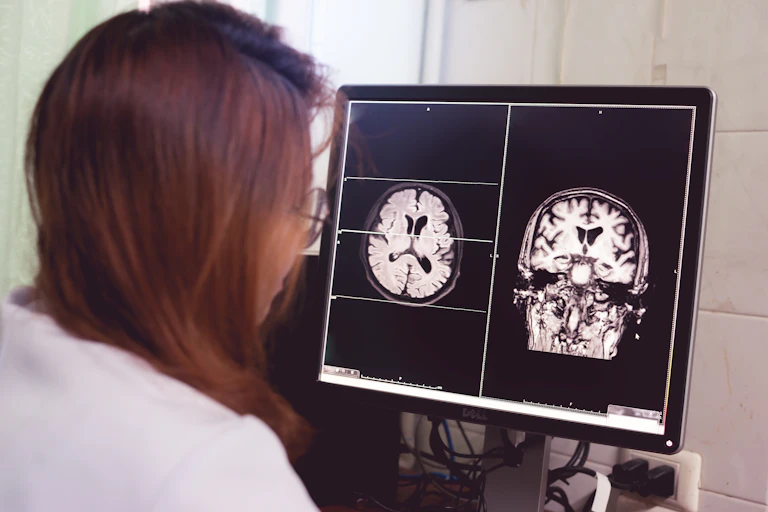 A female doctor wearing a white lab coat looks at brain scans on a computer screen.