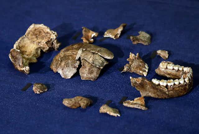 A photo showing a jawbone and fragments of skull arranged on a blue cloth.