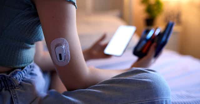Teenage girl sitting on bed with glucose monitor patch on arm, holding smartphone and receiver