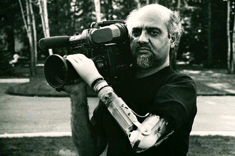 A balding man holds a camera on his shoulder with two arms - one of them is a prosthetic, bionic arm with mechanics and wires exposed.