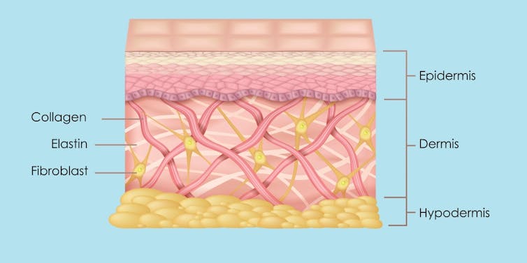 Cross-section of human skin showing epidermis and dermis