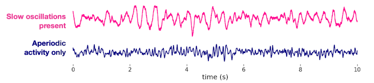 Diagram showing EEG reading of neural oscillations and aperiodic activity