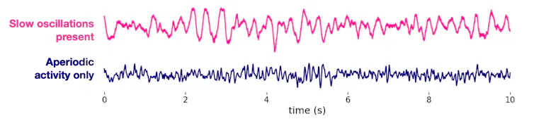 Diagram showing EEG reading of neural oscillations and aperiodic activity