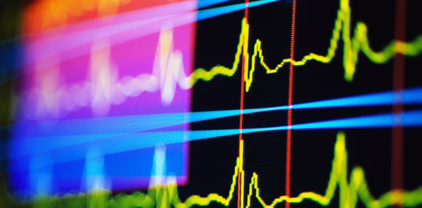 How do pacemakers and defibrillators work? A cardiologist explains how they interact with the electrical system of the heart How do pacemakers and defibrillators work? A cardiologist explains how they interact with the electrical system of the heart