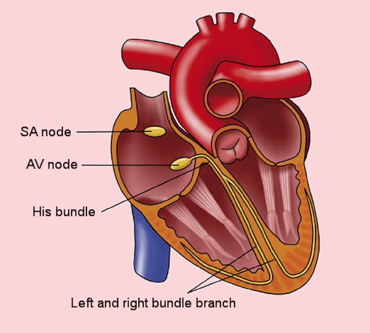 Diagram of cross-section of heart showing the SA and AV nodes