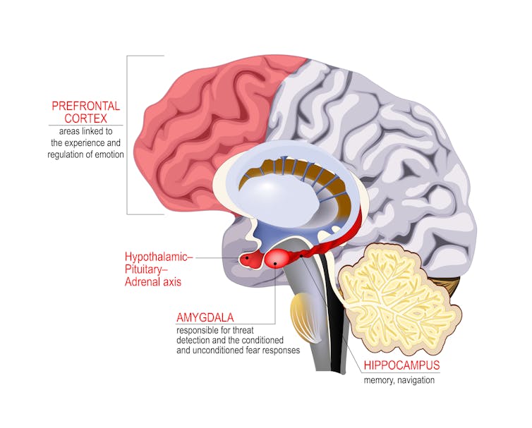 Illustration of a human brain highlighting various brain regions that are associated with stress