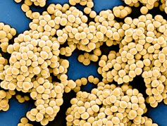clusters of round ivory shapes against a blue background