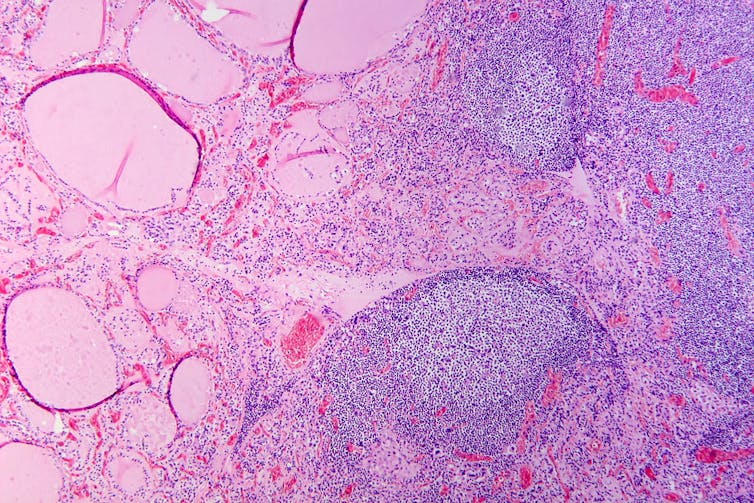 microscopic slide of cells in pink stain