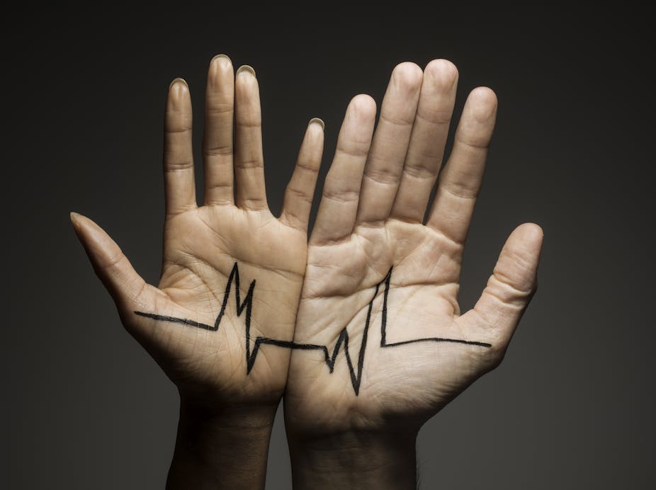 Two hands pressed side by side, connected by an ECG drawing across their open palms