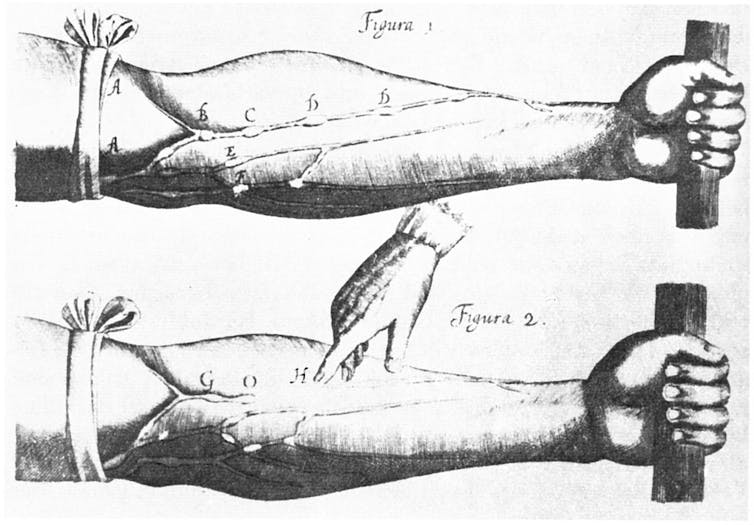 Illustrazione che mostra un braccio che afferra un palo con un laccio emostatico avvolto attorno al gomito.
