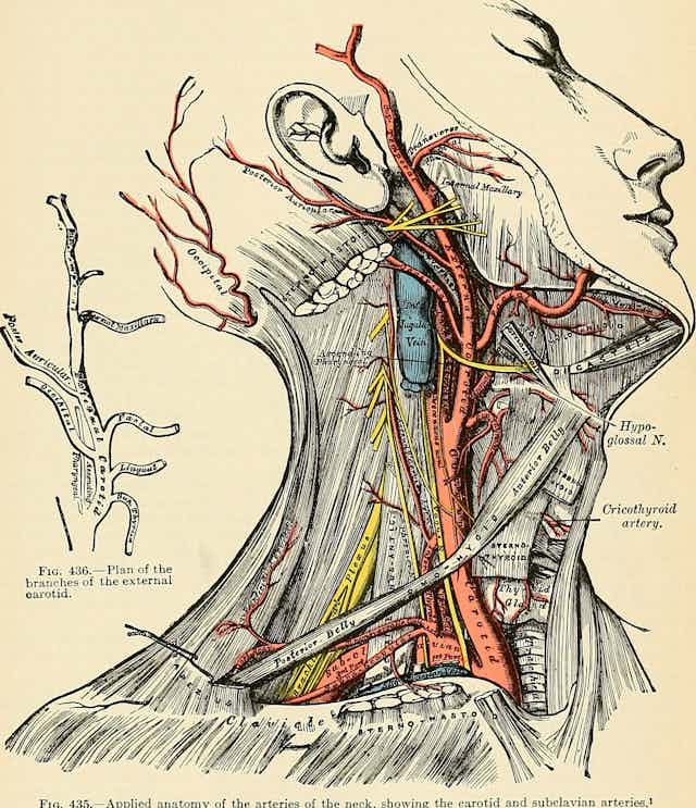 Illustration of the carotid artery in a cross section of a person's neck from the book 'Anatomy, descriptive and applied'