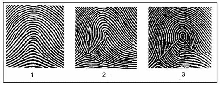 Three fingerprint ridge patterns shown in black and white. The ridges on the left look like a hill, the center looks like a hill with a loop on top, and on the right the ridges form a circle.