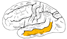 Diagram of brain with the middle temporal gyrus — a strip on the bottom side of the brain — highlighted in yellow
