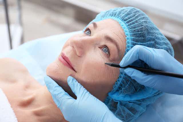 Woman preparing for face lift surgery, on operating table