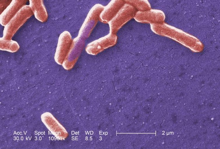 Scanning electron micrograph of an E coli colony