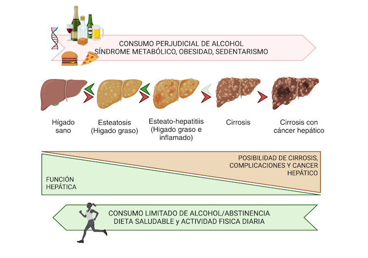 Esquema de la progresión de hígado sano a hígado graso, con esteatohepatitis, con cirrosis y finalmente con cáncer.