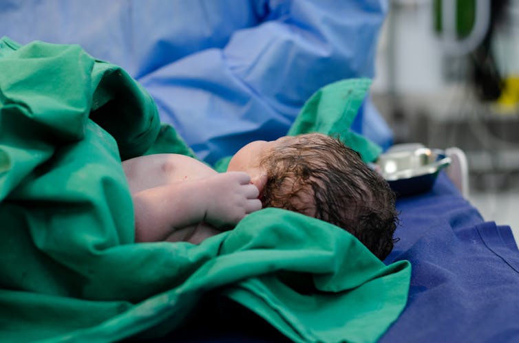 Baby being cleaned after birth