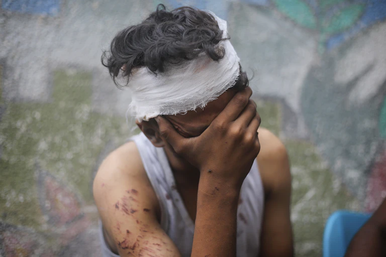 A grieving youth holds his head in his hand.