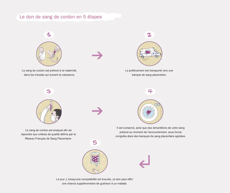 Le schéma montre avec des dessins légendés les 5 étapes nécessaires au don de sang de cordon, depuis le prélèvement jusqu’au don effectif.
