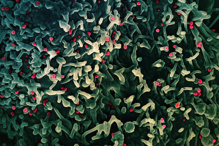 Micrographie électronique à balayage colorisée (fausses couleurs) de virus mpox (en rouge) situés à la surface de cellules VERO E6 infectées (en vert)
