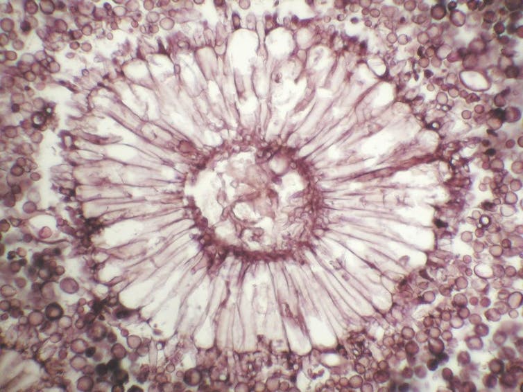 Microscopy image of the conidial head of Aspergillus, reminiscent of a fleshy daisy