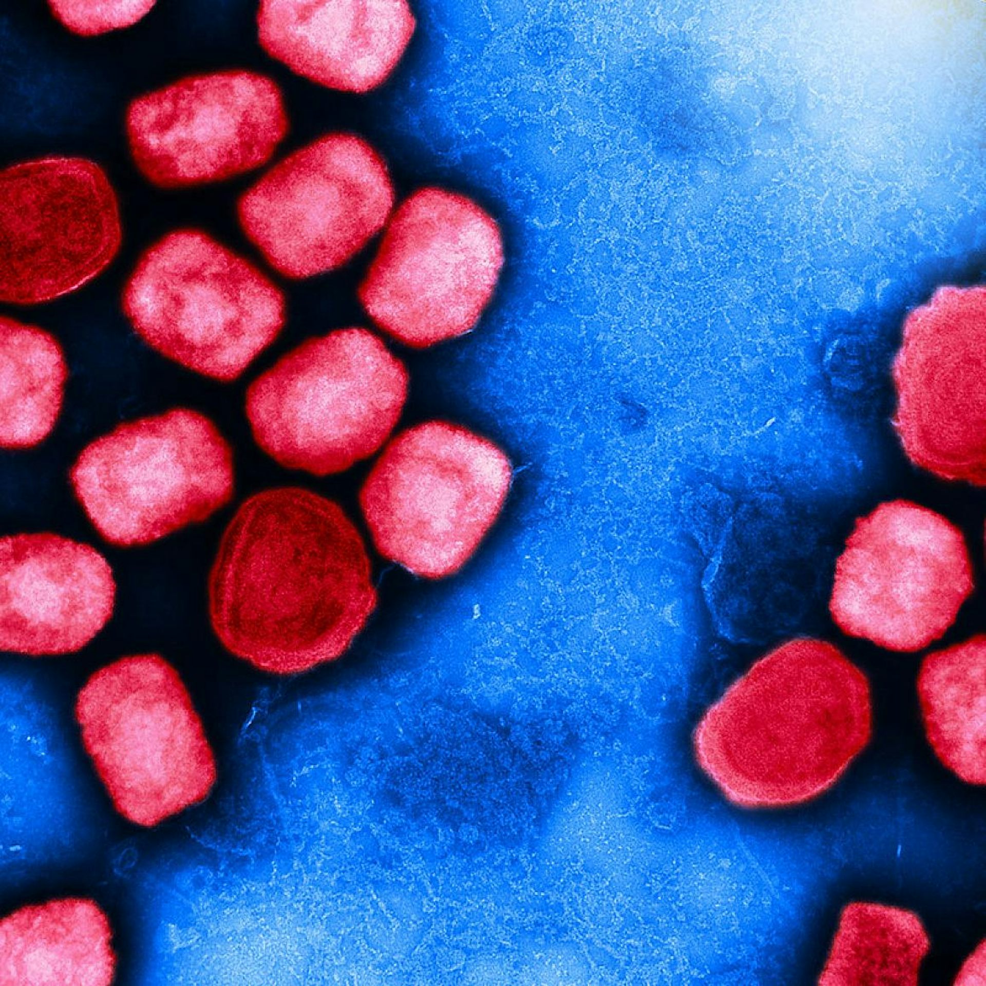 Micrographie électronique à transmission colorisée (fausses couleurs) de particules du virus du mpox (anciennement « variole du singe » - en rouge), cultivées et purifiées à partir d'une culture cellulaire.