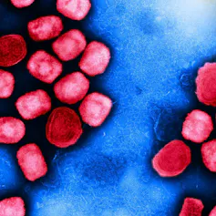 Micrographie électronique à transmission colorisée (fausses couleurs) de particules du virus du mpox (anciennement « variole du singe » - en rouge), cultivées et purifiées à partir d'une culture cellulaire.