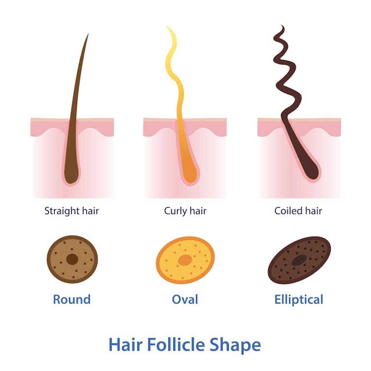 A diagram shows the hair follicle shape of straight, curly and coiled hair.