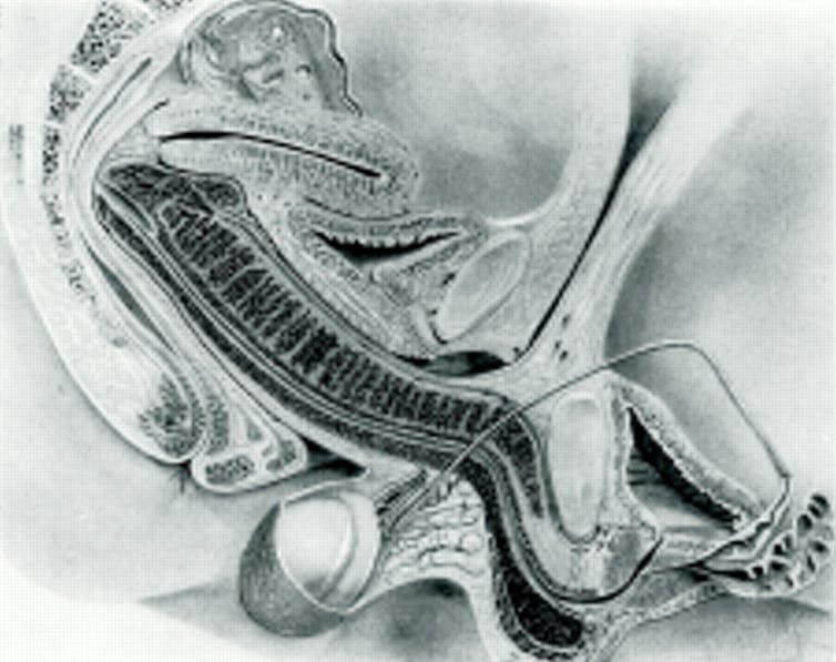 MRI image of anatomy of sexual intercourse.