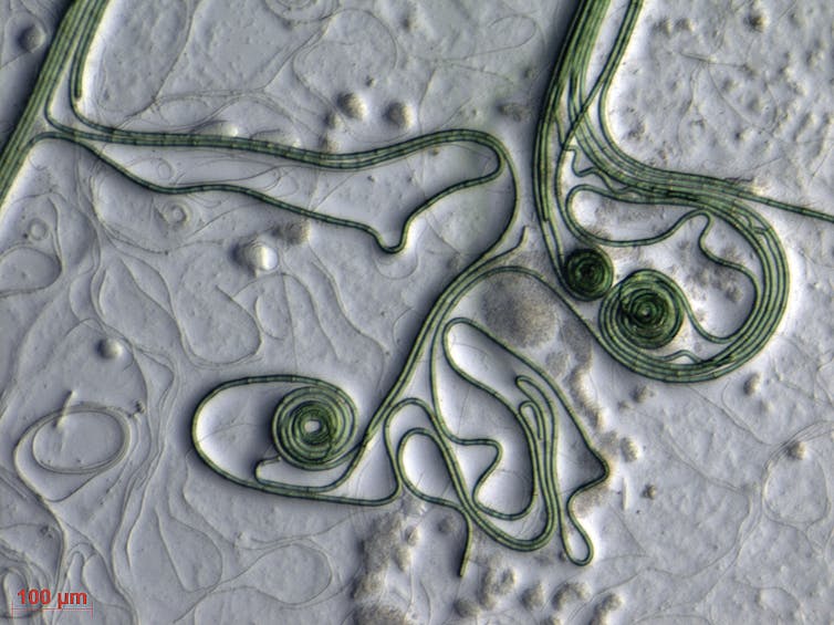 green hair-like strands of bacteria