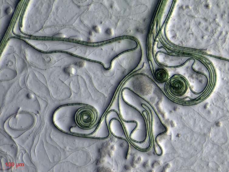 green hair-like strands of bacteria
