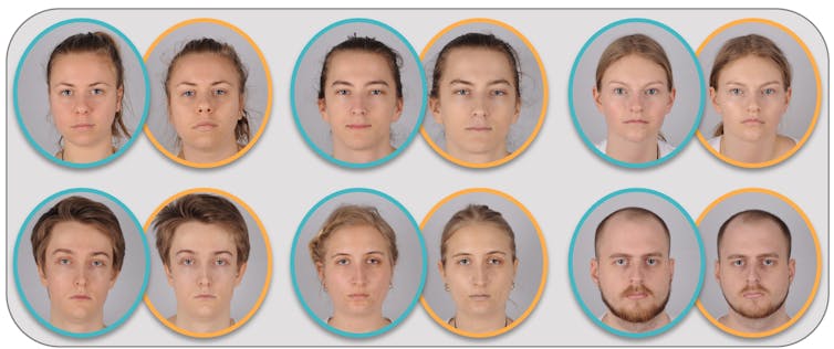 Photos of faces of 3 men and 3 women, one surrounded by blue (control) and one surrounded by orange (injectieon).