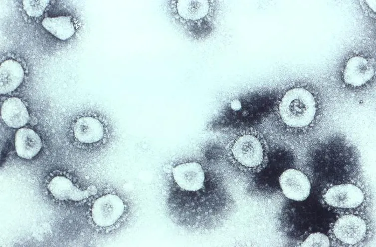 OC43 virions taken with a transmission electron microscopic.